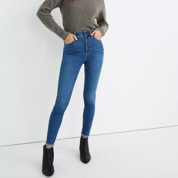 Madewell 10" High-Rise Skinny Jeans in Mackey Wash: Button-Front Edition. - Picture 1 of 6